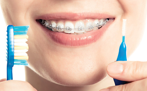 Orthodontic Considerations for the Dental Hygienist
