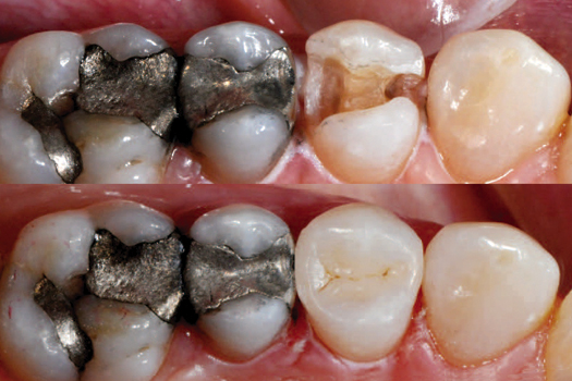 Update in Restorative Dentistry