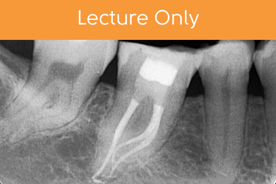 Mini Residency in Endodontics-Lecture