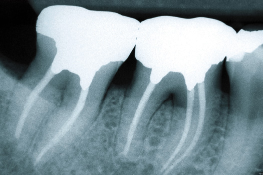 Advanced Contemporary Endodontics