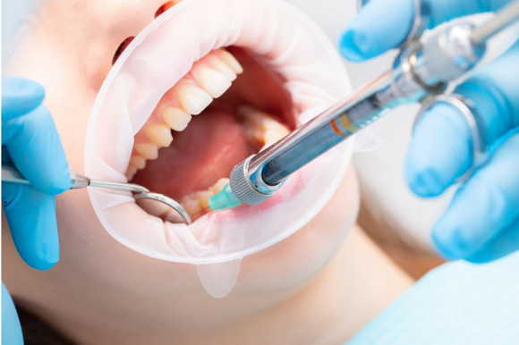 Pain Control in Dentistry