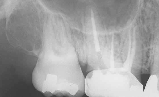 Practical Radiography in Dental Practice