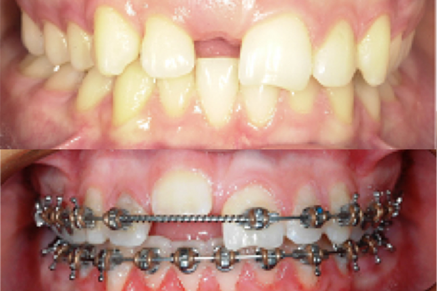 Understanding Orthodontics